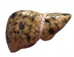 A Bigger Threat to Your Liver Than Alcohol